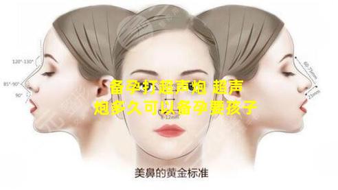 备孕打超声炮 超声炮多久可以备孕要孩子